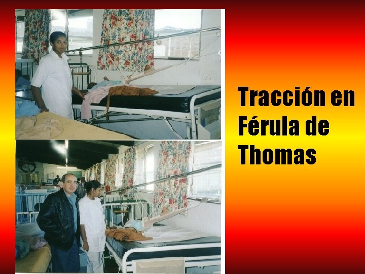 Tracción en Férula de Thomas 