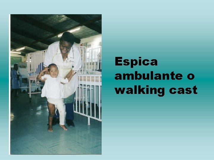 Espica ambulante o walking cast 