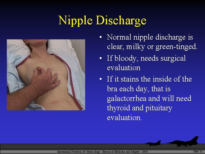 Nipple Discharge • Normal nipple discharge is clear, milky or green-tinged. • If bloody,