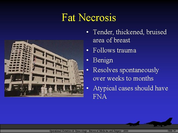 Fat Necrosis • Tender, thickened, bruised area of breast • Follows trauma • Benign