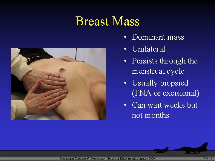 Breast Mass • Dominant mass • Unilateral • Persists through the menstrual cycle •