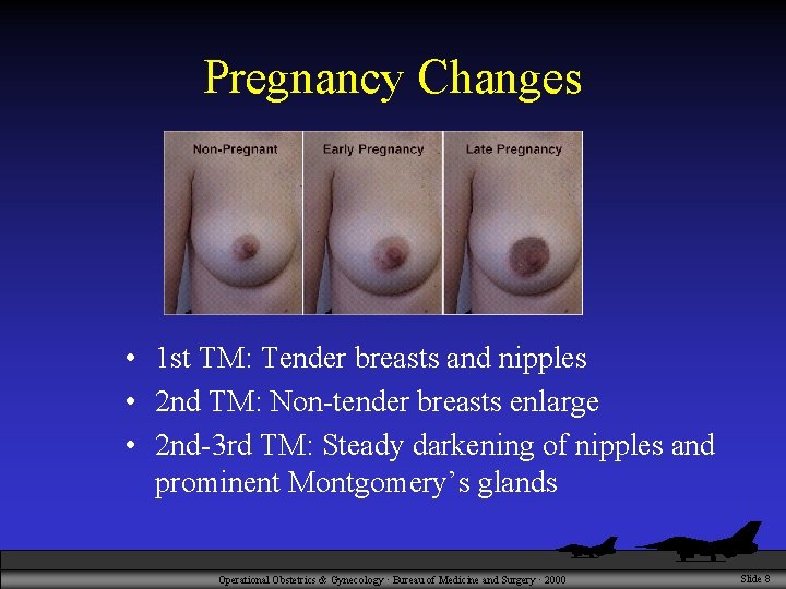 Pregnancy Changes • 1 st TM: Tender breasts and nipples • 2 nd TM: