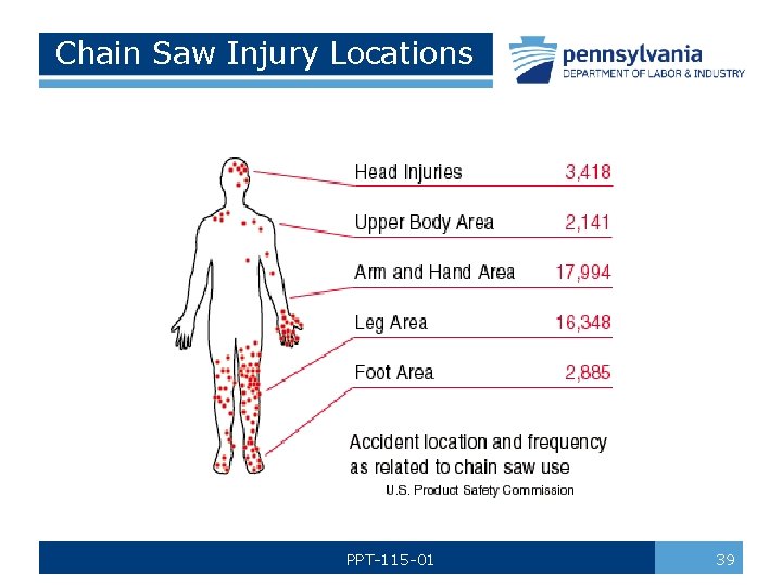 Chain Saw Injury Locations PPT-115 -01 39 