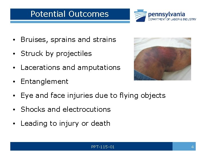 Potential Outcomes • Bruises, sprains and strains • Struck by projectiles • Lacerations and