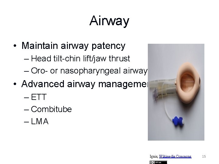 Airway • Maintain airway patency – Head tilt-chin lift/jaw thrust – Oro- or nasopharyngeal