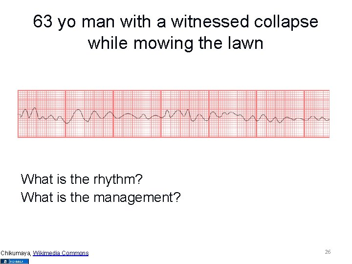 63 yo man with a witnessed collapse while mowing the lawn What is the
