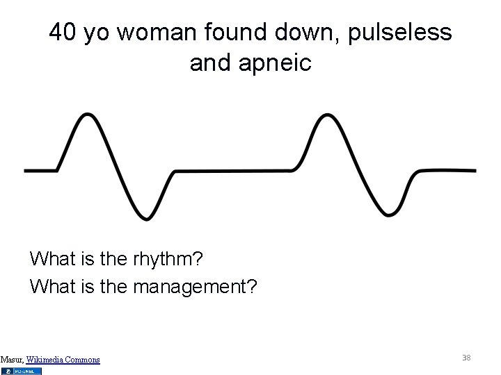 40 yo woman found down, pulseless and apneic What is the rhythm? What is