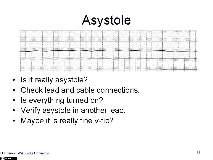 Asystole • • • Is it really asystole? Check lead and cable connections. Is