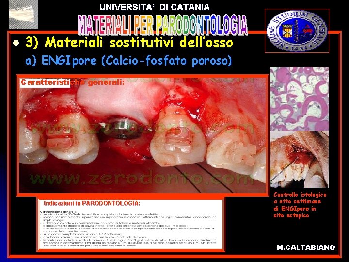 UNIVERSITA’ DI CATANIA l l 3) Materiali sostitutivi dell’osso a) ENGIpore (Calcio-fosfato poroso) Caratteristiche