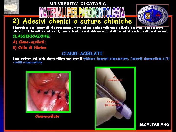 UNIVERSITA’ DI CATANIA l 2) Adesivi chimici o suture chimiche S’intendono quei materiali che