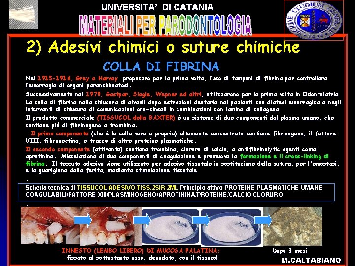 UNIVERSITA’ DI CATANIA 2) Adesivi chimici o suture chimiche l l l COLLA DI