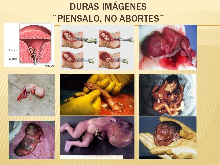 DURAS IMÁGENES ¨PIENSALO, NO ABORTES¨ 