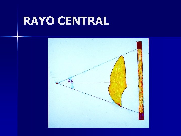 RAYO CENTRAL 