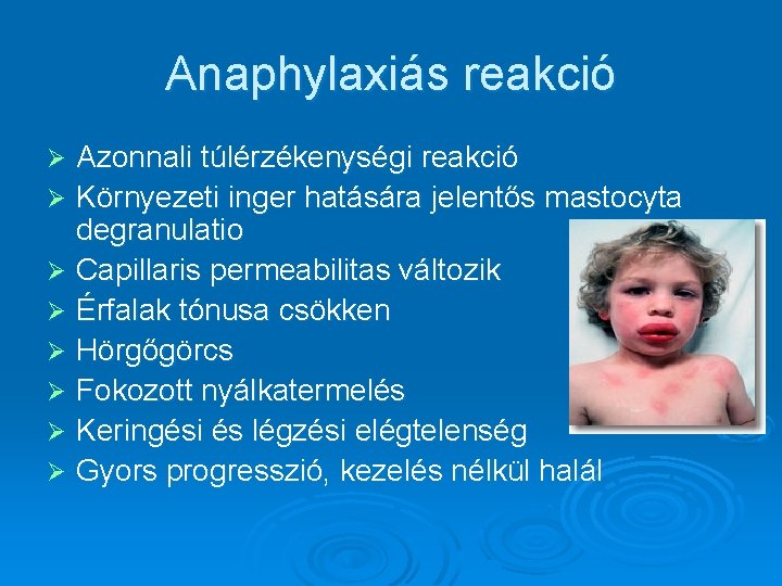 Anaphylaxiás reakció Azonnali túlérzékenységi reakció Ø Környezeti inger hatására jelentős mastocyta degranulatio Ø Capillaris