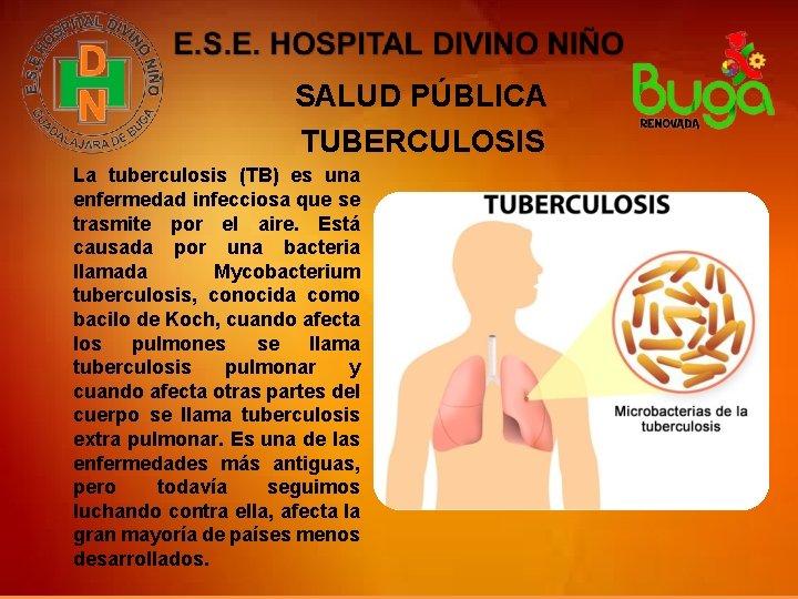 SALUD PÚBLICA TUBERCULOSIS La tuberculosis (TB) es una enfermedad infecciosa que se trasmite por