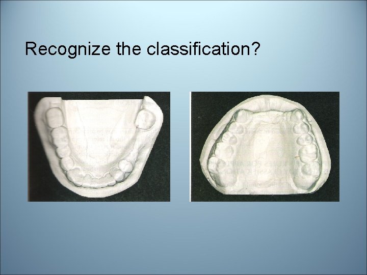 Recognize the classification? 