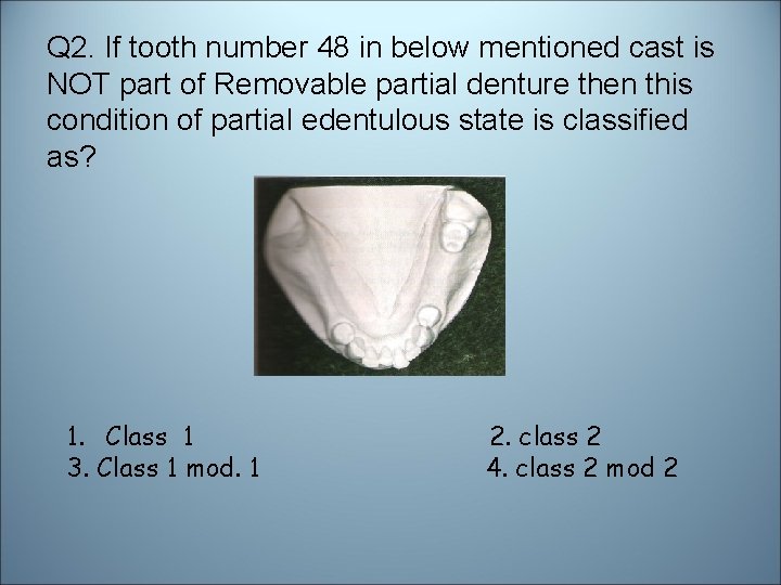 Q 2. If tooth number 48 in below mentioned cast is NOT part of