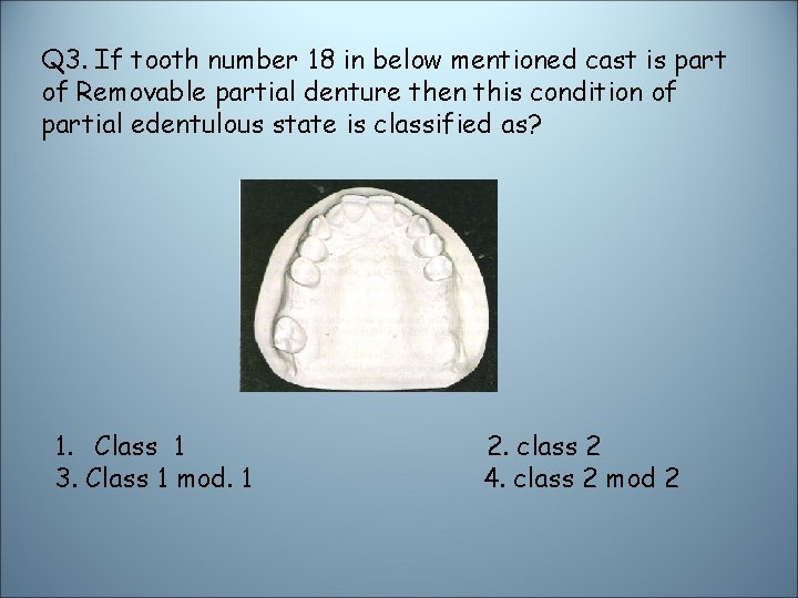 Q 3. If tooth number 18 in below mentioned cast is part of Removable