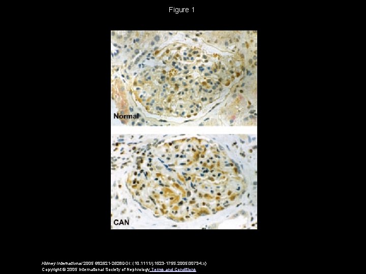 Figure 1 Kidney International 2005 682621 -2628 DOI: (10. 1111/j. 1523 -1755. 2005. 00734.