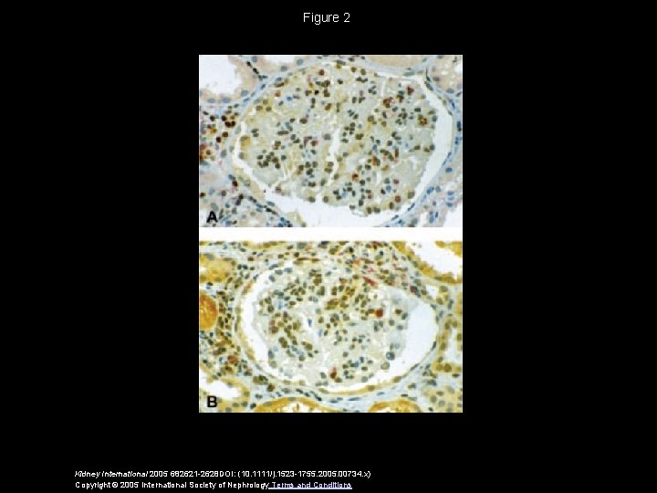 Figure 2 Kidney International 2005 682621 -2628 DOI: (10. 1111/j. 1523 -1755. 2005. 00734.