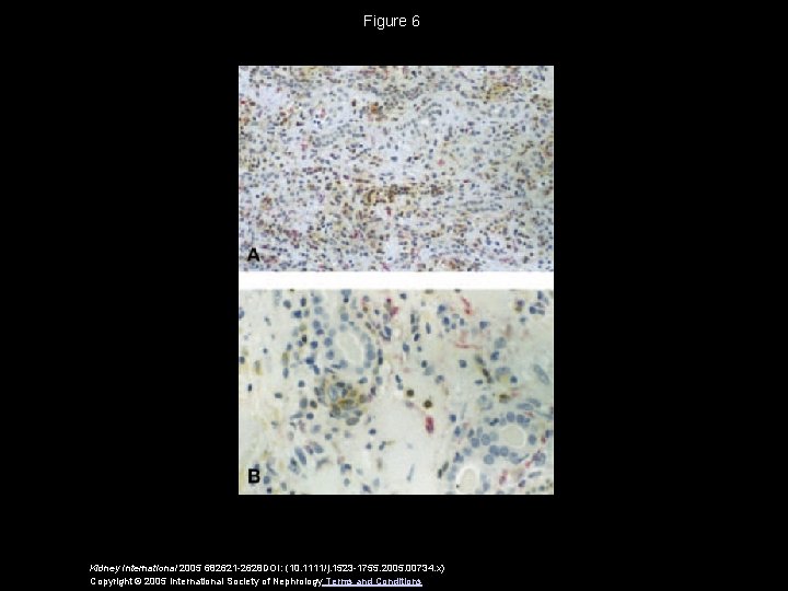 Figure 6 Kidney International 2005 682621 -2628 DOI: (10. 1111/j. 1523 -1755. 2005. 00734.