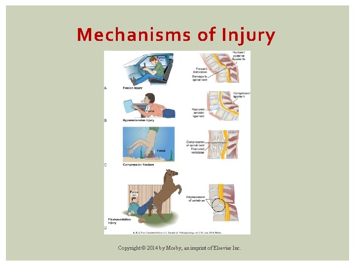 Mechanisms of Injury Copyright © 2014 by Mosby, an imprint of Elsevier Inc. 