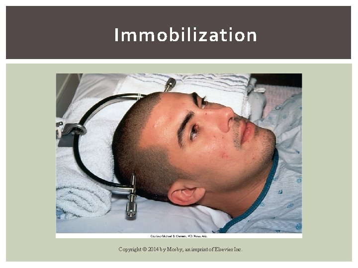 Immobilization Copyright © 2014 by Mosby, an imprint of Elsevier Inc. 