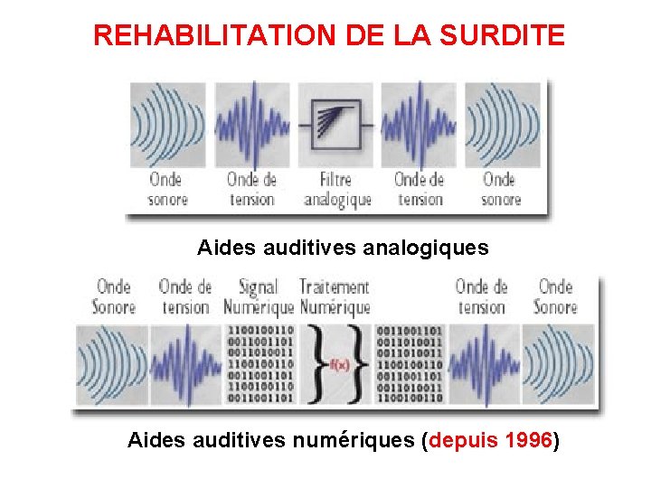 REHABILITATION DE LA SURDITE Aides auditives analogiques Aides auditives numériques (depuis 1996) 