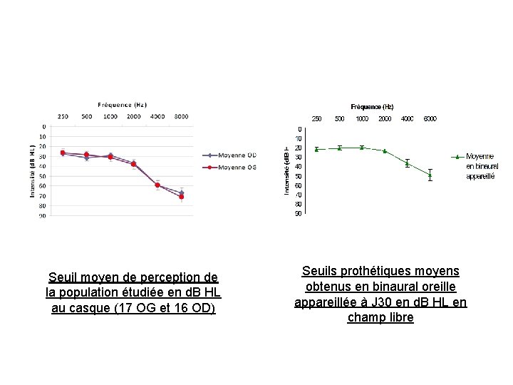 Seuil moyen de perception de la population étudiée en d. B HL au casque