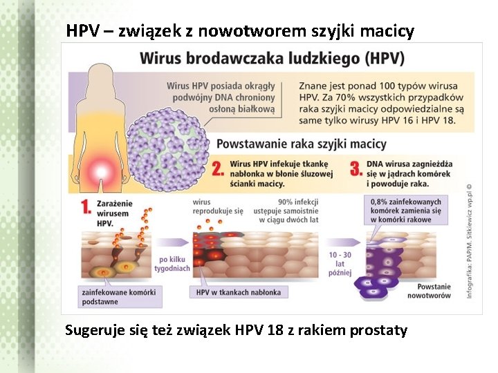 HPV – związek z nowotworem szyjki macicy Sugeruje się też związek HPV 18 z