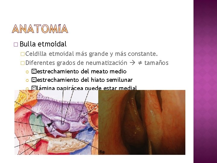 � Bulla etmoidal � Celdilla etmoidal más grande y más constante. � Diferentes grados