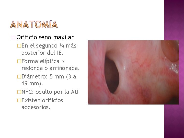 � Orificio seno maxilar �En el segundo ¼ más posterior del IE. �Forma elíptica