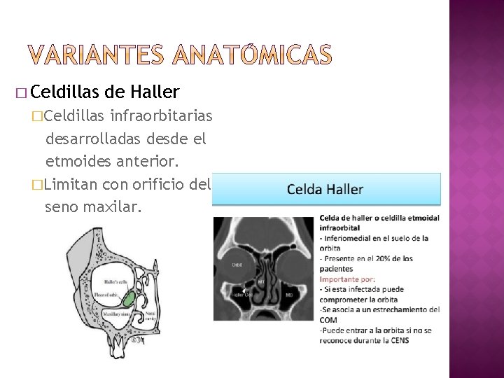 � Celdillas de Haller �Celdillas infraorbitarias desarrolladas desde el etmoides anterior. �Limitan con orificio