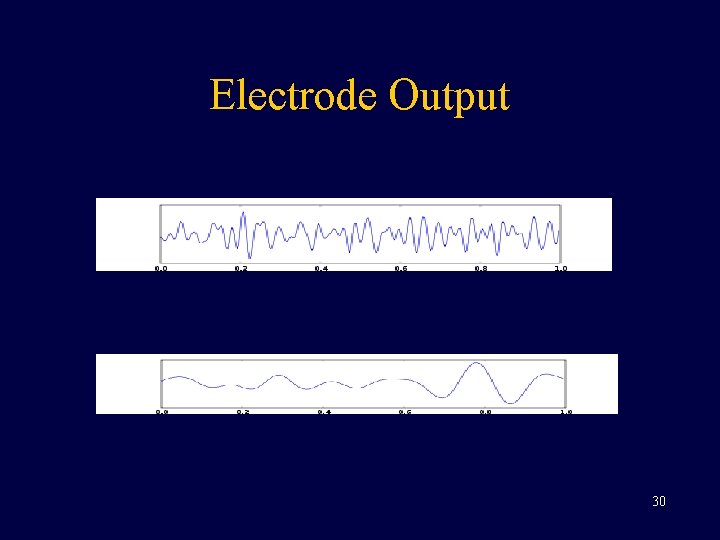 Electrode Output 30 