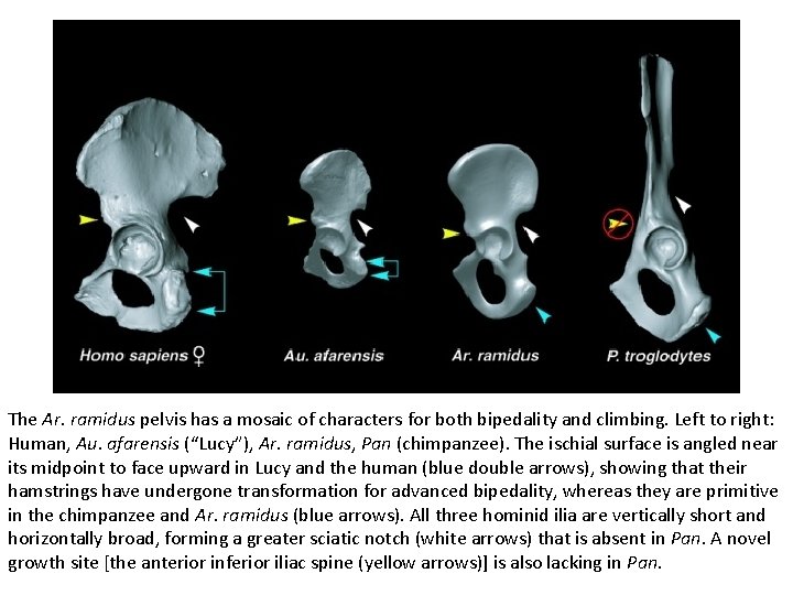 The Ar. ramidus pelvis has a mosaic of characters for both bipedality and climbing.