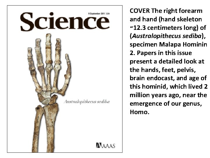 COVER The right forearm and hand (hand skeleton ∼ 12. 3 centimeters long) of