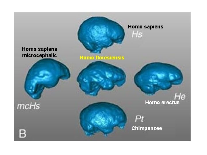 Homo sapiens microcephalic Homo floresiensis Homo erectus Chimpanzee 