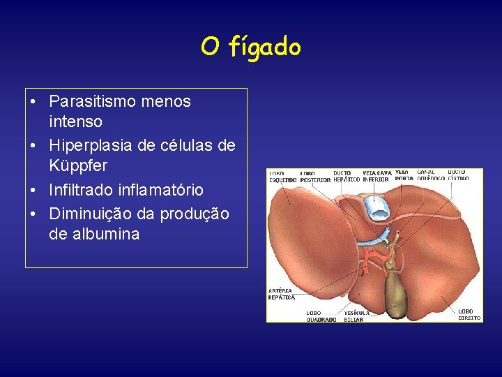 O fígado • Parasitismo menos intenso • Hiperplasia de células de Küppfer • Infiltrado