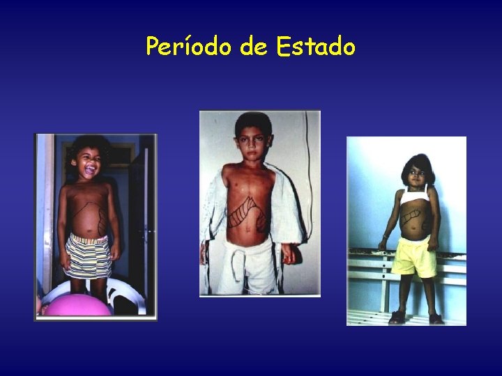Período de Estado 