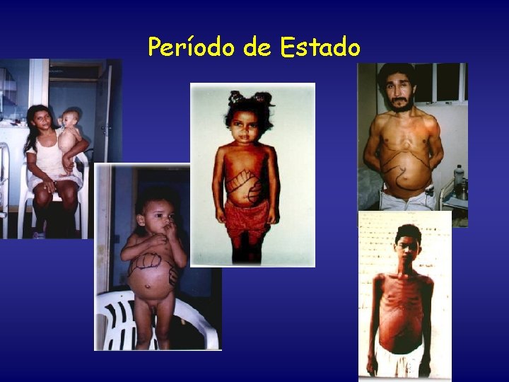 Período de Estado 