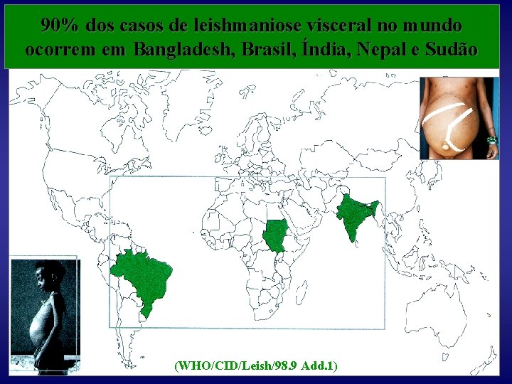 90% dos casos de leishmaniose visceral no mundo ocorrem em Bangladesh, Brasil, Índia, Nepal
