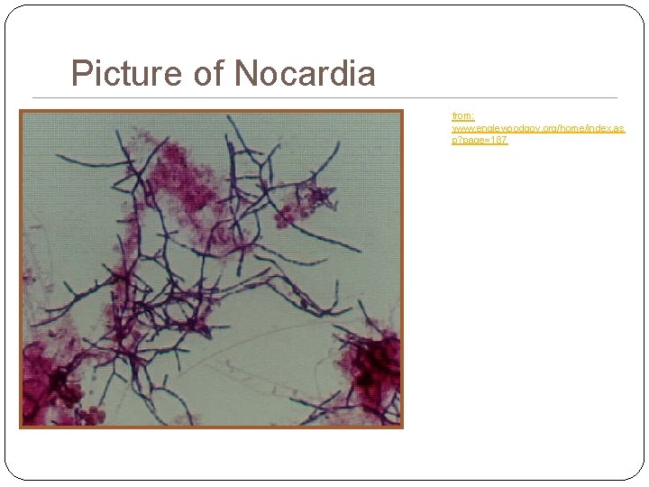 Picture of Nocardia from: www. englewoodgov. org/home/index. as p? page=187 