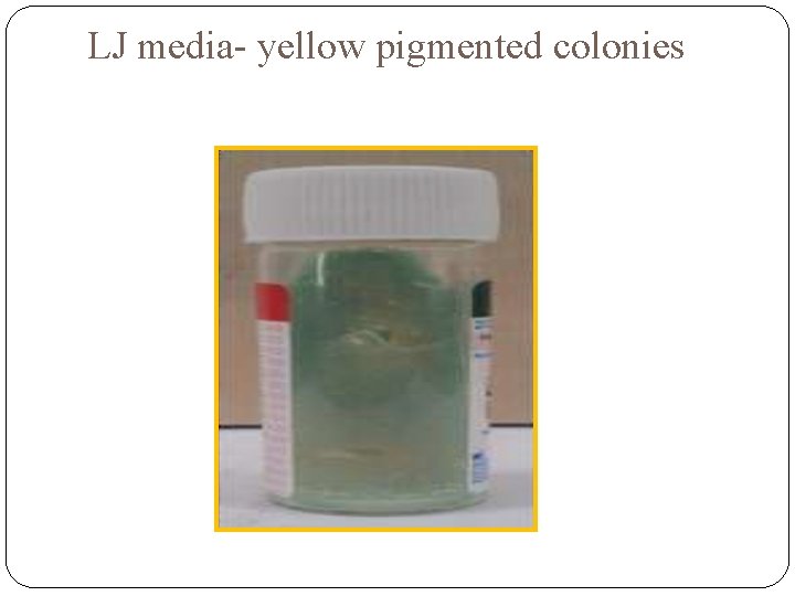 LJ media- yellow pigmented colonies 