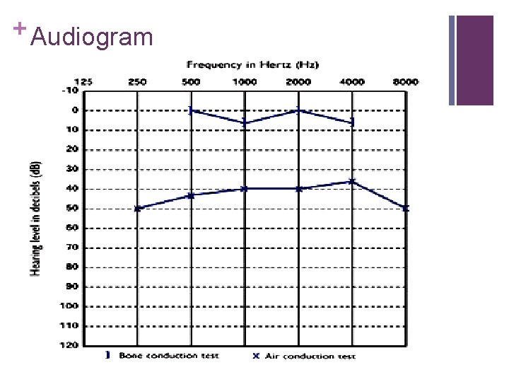 + Audiogram 