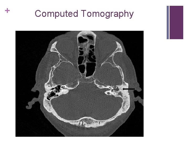 + Computed Tomography 