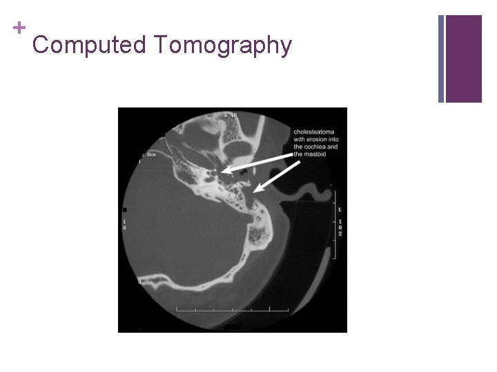 + Computed Tomography 