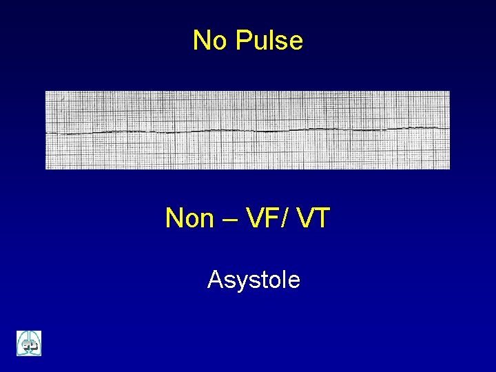 No Pulse Non – VF/ VT Asystole 