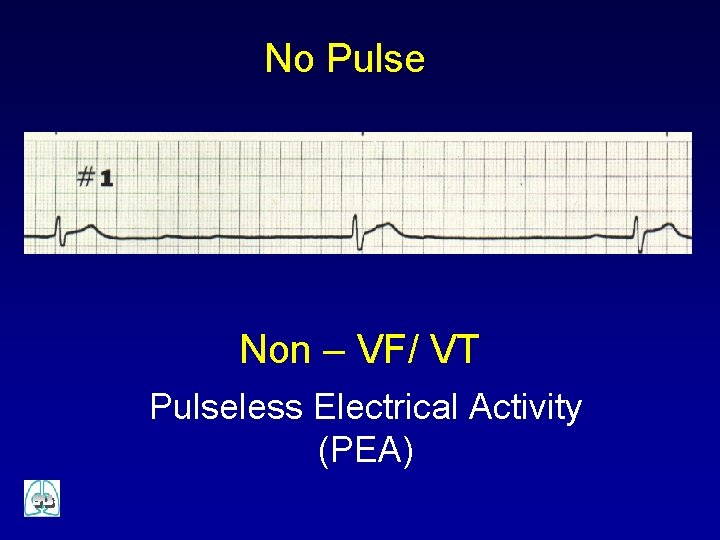 No Pulse Non – VF/ VT Pulseless Electrical Activity (PEA) 