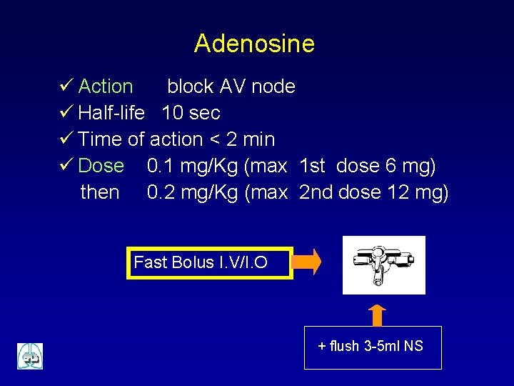 Adenosine ü Action block AV node ü Half-life 10 sec ü Time of action