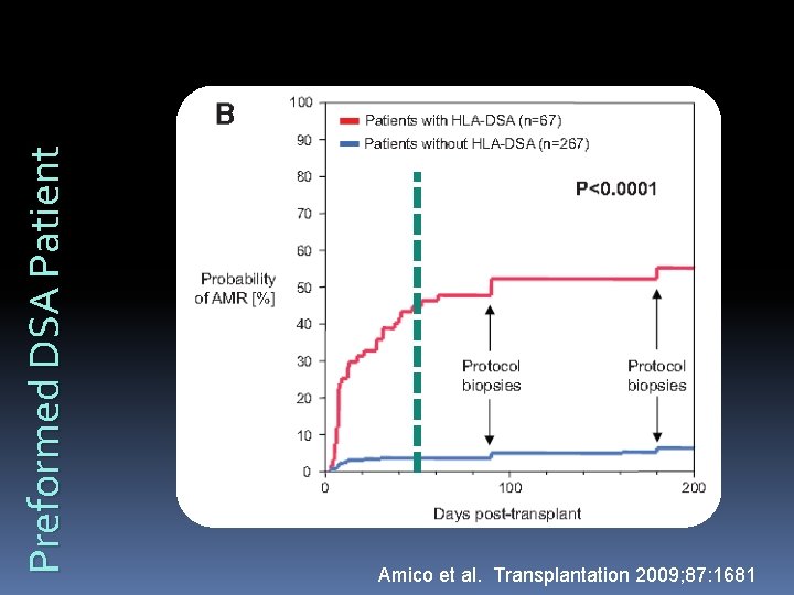 Preformed DSA Patient Amico et al. Transplantation 2009; 87: 1681 